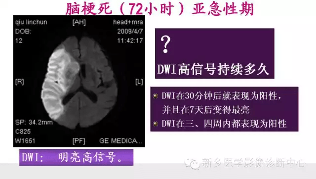 脑梗塞分期最新标准